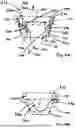 Fig. 14 - Corded Leaflet Free Edge Valve