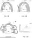 Fig. 09 - METHODS FOR DETERMINING ATTACHMENT PLACEMENT APPLIANCE GEOMETRY