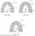 Fig. 10 - METHODS FOR DETERMINING ATTACHMENT PLACEMENT APPLIANCE GEOMETRY