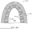 Fig. 11 - METHODS FOR DETERMINING ATTACHMENT PLACEMENT APPLIANCE GEOMETRY