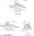Fig. 12 - METHODS FOR DETERMINING ATTACHMENT PLACEMENT APPLIANCE GEOMETRY