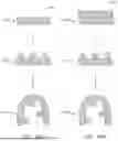 Fig. 18 - METHODS FOR DETERMINING ATTACHMENT PLACEMENT APPLIANCE GEOMETRY