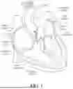 Fig. 02 - PROSTHETIC HEART VALVE WITH SUTURE LOOP PREVENTING MEMBER