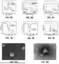 Fig. 04 - ON-DEMAND RELEASE OF ANTIBIOTIC COMPOSITION AND METHOD FOR TREATING INFECTIONS