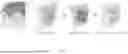 Fig. 04 - ADHESIVE PARTICLES FOR ACTIVE DELIVERY