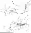 Fig. 06 - SYSTEM AND METHOD FOR DELIVERING THERAPEUTIC AGENTS TO THE UTERINE CAVITY