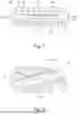 Fig. 02 - LEAD WIRE SLIDE, ASSEMBLY GROUP, AND MEDICAL SYSTEM
