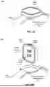 Fig. 03 - SENSOR SHIFT FOR OPTICAL IMAGE STABILIZATION AND FOCUSING IN COMPACT CAMERA DEVICES