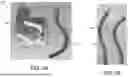 Fig. 05 - VENTRICULAR ASSIST SYSTEM AND METHOD OF TREATMENT OF CARDIOVASCULAR IMPAIRMENT