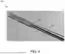 Fig. 12 - VENTRICULAR ASSIST SYSTEM AND METHOD OF TREATMENT OF CARDIOVASCULAR IMPAIRMENT