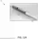 Fig. 17 - VENTRICULAR ASSIST SYSTEM AND METHOD OF TREATMENT OF CARDIOVASCULAR IMPAIRMENT