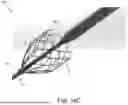 Fig. 23 - VENTRICULAR ASSIST SYSTEM AND METHOD OF TREATMENT OF CARDIOVASCULAR IMPAIRMENT