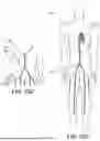 Fig. 43 - VENTRICULAR ASSIST SYSTEM AND METHOD OF TREATMENT OF CARDIOVASCULAR IMPAIRMENT