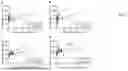 Fig. 06 - CELL-FREE DNA CONCENTRATION IN HYPOTHERMIC MACHINE PERFUSATE AS A RAPID MARKER FOR KIDNEY GRAFT QUALITY
