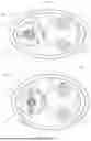 Fig. 05 - SIDE-COUPLED ACTIVE AND PASSIVE WAVEGUIDES WITH EMBEDDED ELEMENTS FOR IMPROVED LIGHT ABSORPTION