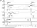 Fig. 67 - ULTRA-NARROW PULSE EMISSION LASER DIODE DRIVER