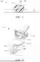Fig. 04 - Transition Fixing