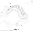 Fig. 10 - High Voltage Cable Cleat