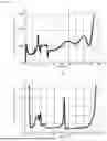 Fig. 07 - CHARGER WITH DATA COLLECTION FUNCTION FOR OCV DEGRADATION ANALYSIS, AND METHOD OF ACQUIRING OCV DATA