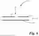 Fig. 05 - INTEGRATION OF COIL AND CAPACITOR FOR A WIRELESS POWER SYSTEM