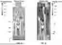 Fig. 09 - SYSTEMS, DEVICES, AND METHODS FOR IMPROVING HEAT DISSIPATION
