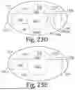 Fig. 27 - SCHOTTKY BARRIER DIODE (SBD) LEAKAGE CURRENT BLOCKING STRUCTURE