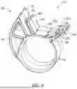 Fig. 09 - FORAGE HARVEST MACHINES HAVING MOVEABLE ROTOR ASSEMBLY TROUGH PORTIONS