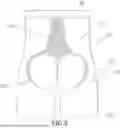 Fig. 06 - SHAPEWEAR GARMENT