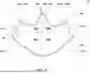 Fig. 10 - GUSSET FOR A GARMENT