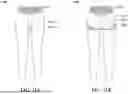Fig. 12 - GUSSET FOR A GARMENT