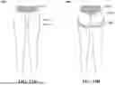 Fig. 17 - GUSSET FOR A GARMENT