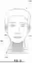 Fig. 04 - APPARATUS FOR RESTRICTING HEAD MOVEMENT