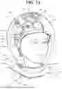 Fig. 02 - Helmet Safety System