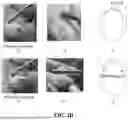 Fig. 04 - NAIL CARE METHOD USING NAIL BIT WITHOUT USING NIPPER