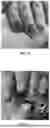 Fig. 07 - NAIL CARE METHOD USING NAIL BIT WITHOUT USING NIPPER