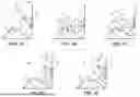Fig. 08 - HOPPER INDICATOR