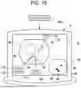 Fig. 16 - MEDICAL SUPPORT DEVICE, ENDOSCOPE, MEDICAL SUPPORT METHOD, AND PROGRAM