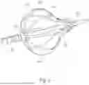 Fig. 07 - Ablation Catheters with Deployable Electrode Structures for Use in Ablation and Electrophysiological Mapping