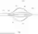 Fig. 08 - Ablation Catheters with Deployable Electrode Structures for Use in Ablation and Electrophysiological Mapping