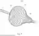 Fig. 10 - Ablation Catheters with Deployable Electrode Structures for Use in Ablation and Electrophysiological Mapping
