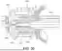 Fig. 25 - Ablation Catheters with Deployable Electrode Structures for Use in Ablation and Electrophysiological Mapping