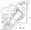 Fig. 28 - Ablation Catheters with Deployable Electrode Structures for Use in Ablation and Electrophysiological Mapping