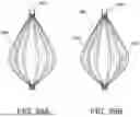 Fig. 33 - Ablation Catheters with Deployable Electrode Structures for Use in Ablation and Electrophysiological Mapping