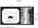 Fig. 12 - MEDICAL DEVICE, ENDOSCOPE SYSTEM, CONTROL METHOD, AND COMPUTER-READABLE RECORDING MEDIUM