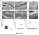 Fig. 31 - SYSTEM FOR STABILIZED NONINVASIVE IMAGING OF MICROVASCULATURE IN THE ORAL MUCOSA
