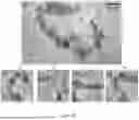 Fig. 34 - SYSTEM FOR STABILIZED NONINVASIVE IMAGING OF MICROVASCULATURE IN THE ORAL MUCOSA