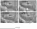 Fig. 35 - SYSTEM FOR STABILIZED NONINVASIVE IMAGING OF MICROVASCULATURE IN THE ORAL MUCOSA