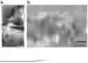 Fig. 36 - SYSTEM FOR STABILIZED NONINVASIVE IMAGING OF MICROVASCULATURE IN THE ORAL MUCOSA