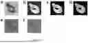 Fig. 38 - SYSTEM FOR STABILIZED NONINVASIVE IMAGING OF MICROVASCULATURE IN THE ORAL MUCOSA