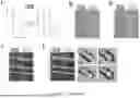 Fig. 42 - SYSTEM FOR STABILIZED NONINVASIVE IMAGING OF MICROVASCULATURE IN THE ORAL MUCOSA